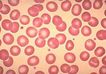 Eritrocitos normales donde se ve el color rojo que adquieren por la presencia de la hemoglobina.

Aumento:
400 veces

Coloración:
May Grunwald - Giemsa